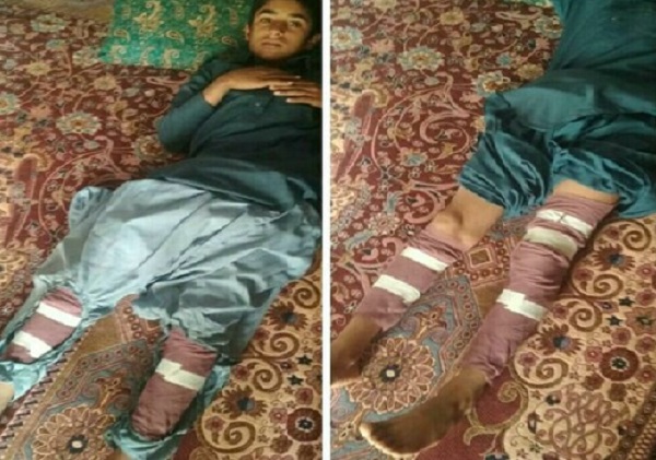 دانش‌آموز دیگری قربانی چراغ‌نفتی‌ شد